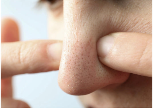 毛穴ケアはLipico SCオイルを使って毛穴汚れやくすみ肌に！ キメ肌作りでワントーンアップ